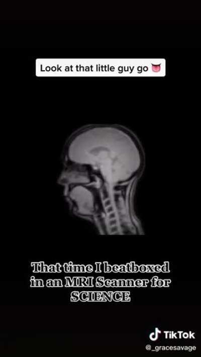 Beatboxing in an MRI (not OC, link in comments)