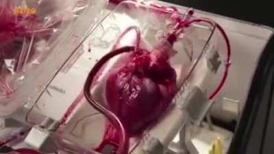 Live heart before heart surgery