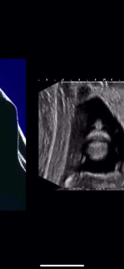 My wife is pregnant… with the Sith Lord?!?!