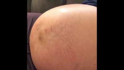 Baby standing up in belly! Wild kicks and movement 38 weeks by (Zach Beatty)