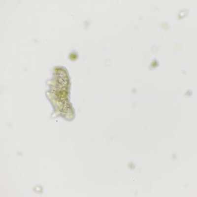 [OC] Finally found this guy under microscope. Yes tardigrades are cute too.