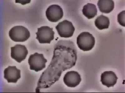 Human white blood cell chasing a bacteria and eating it alive. Immunity at work