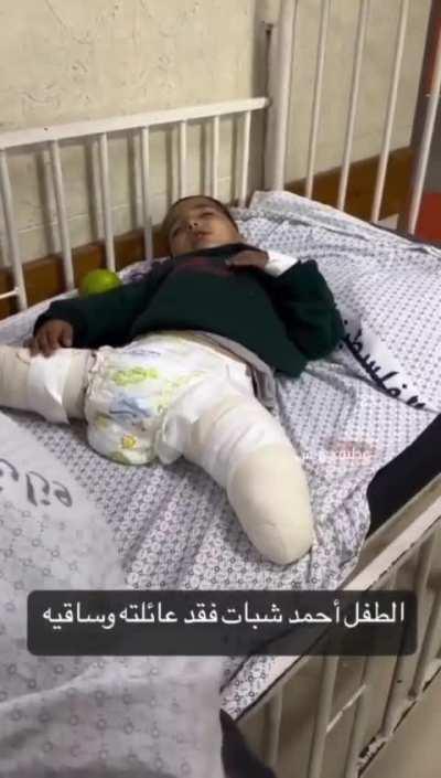 His name is Ahmed. They took his family and his legs.