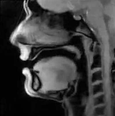 Real-time MRI of the speaker