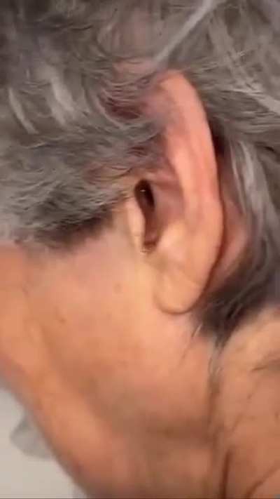 What's that in her ear?