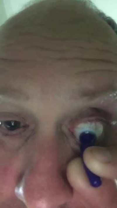 Taking out a contact lens