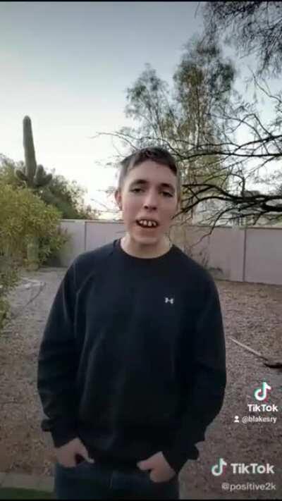 Guy fakes having rotten teeth to manipulate audience into donating loads of money to him.