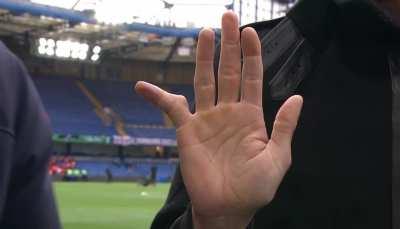 Rob Green shows off his freakishly deformed pinky, a casualty of a 21 year career as a goalkeeper