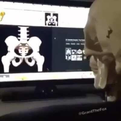 Boner