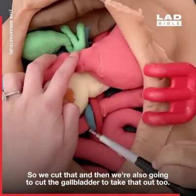 Mom teaches son to do surgery with play dough