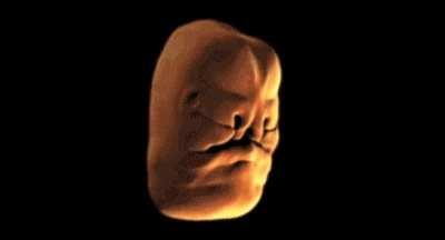 This is how an embryo folds to create the structures of the human face in the womb.