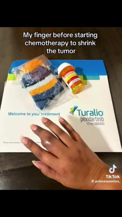 I'd like to know how they missed the tumor during the first surgery.
