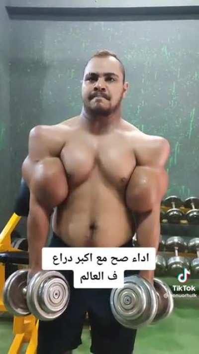 This guy's appearance after Synthol Injections : r/oddlyterrifying