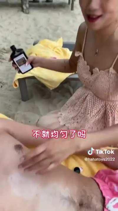 hahatoys2022 on TikTok tries to fix a sunburn