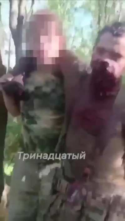 [Graphic] One of the invaders of 30th regiment was seriously wounded - his jaw was torn off, current condition is unknown. Volchansk direction.