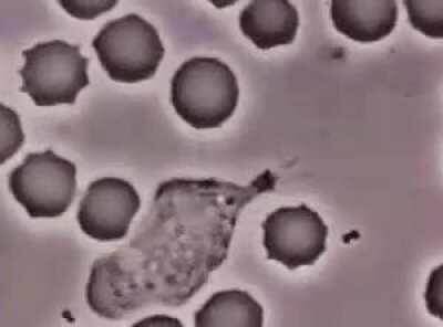 A white blood cell pursues a bacterium.