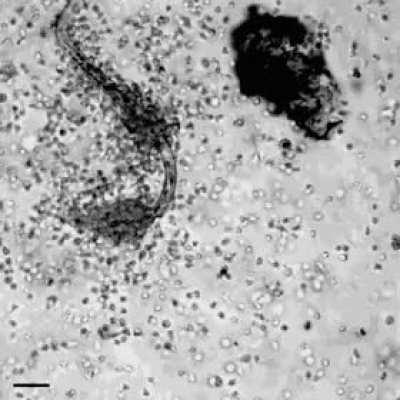 White Blood cells attacking a parasite