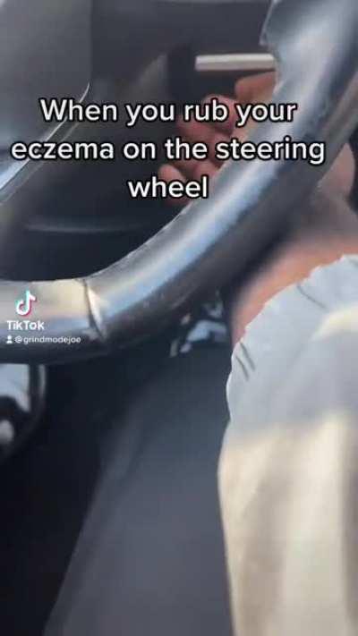 When you rub your eczema on the steering wheel