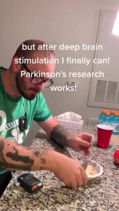 Deep brain stimulation (DBS) for relieving Parkinson's. This technology is helping millions of people with the disease to properly eat.