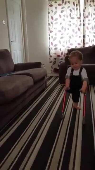 Little Champion Learns To Walk Without a Leg!!