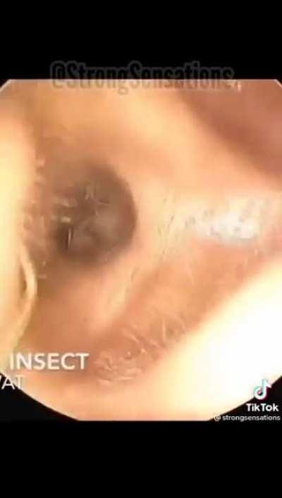 Ear insect