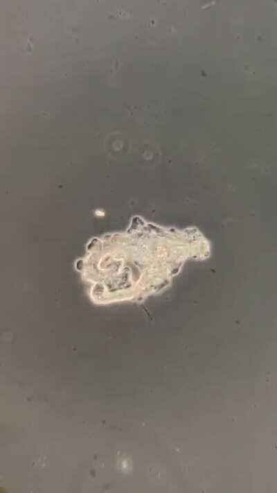 An Amoeba engulfing another protist (Phagocytosis)