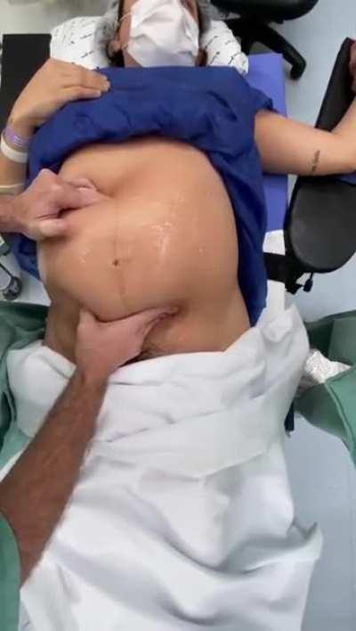 Doctor turning baby inside mother's belly to avoid cesarean birth [nsfw]