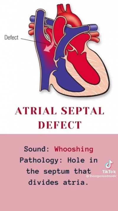 Heart sounds through a stethoscope