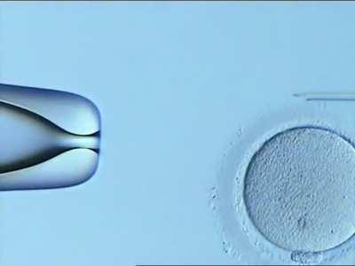 A Person Being Conceived | IVF