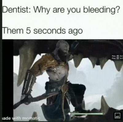 I sent this to my Dentist