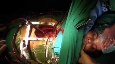 Awake cardiac surgery