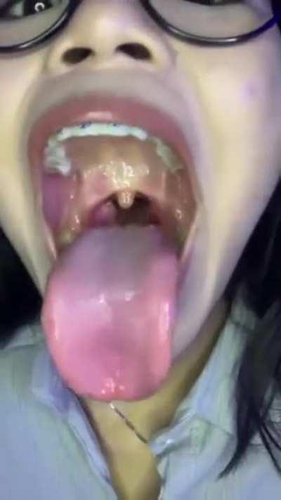 tongue view