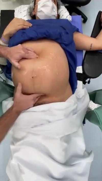 Doctor turning baby inside mother's belly to avoid cesarean birth