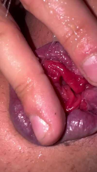 Look at my prolapse, I can put almost 5 fingers in. My gf managed to fist me, but my fist for my anal is a lil too big.