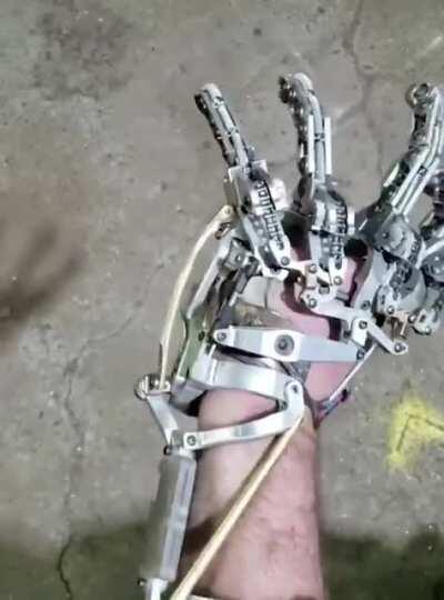 Prosthetic hand.