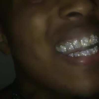 Jahseh showing off his diamonds