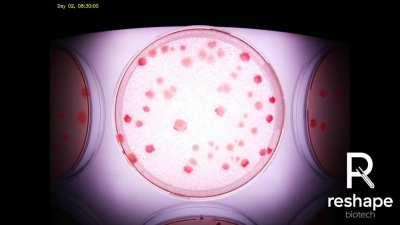 We're the guys who made an automatic plate filler. We're now back with new robot that makes time lapses of microbial growth!