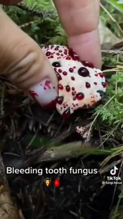 Squeezing a Bleeding tooth fungus.