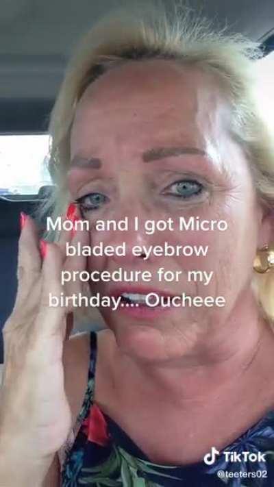 Mother and daughter after microblading