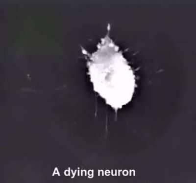 This is what a dying Neuron looks like.