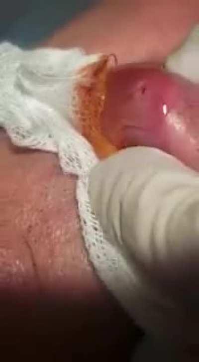 Grub worm getting pulled out of someone’s lips