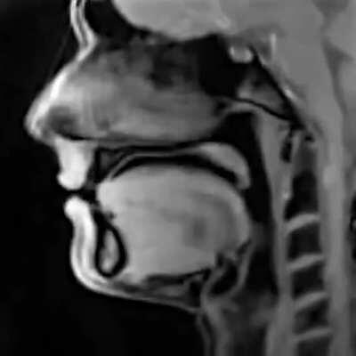 Eerie MRI of a person talking.