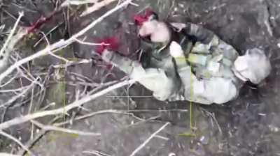 Ukrainian soldier losses his legs after an explosion 