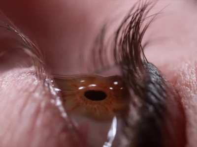 👀Close-up of eye drops in slow motion👀