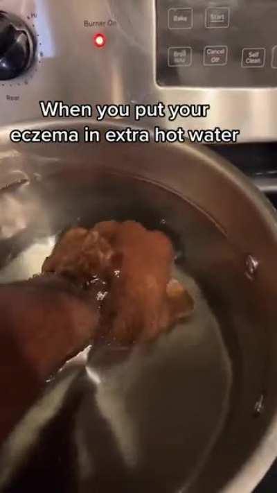 When you put your eczema in extra hot water