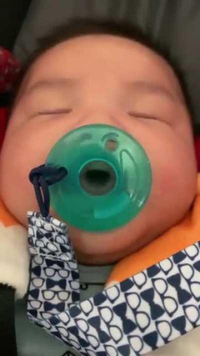 My son’s mouth looks funny sucking on his pacifier