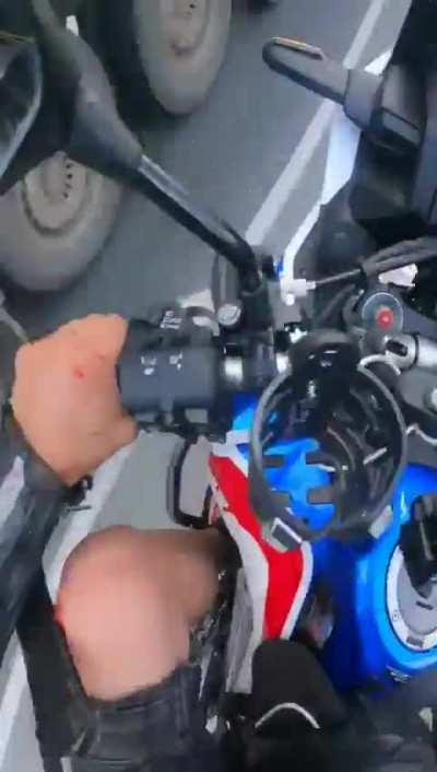 Guy loses his foot in crash with motorcycle 