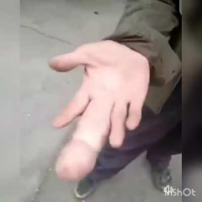 Shocking finger