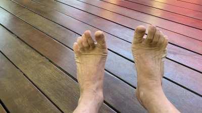 When I flex my toes, you can really see how modern shoes have realigned my big toes. Been using toe spreaders, but is there something else I can do to aid in maintaining a “spread” when I flex?