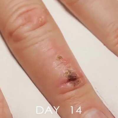 Wound healing in time lapse video